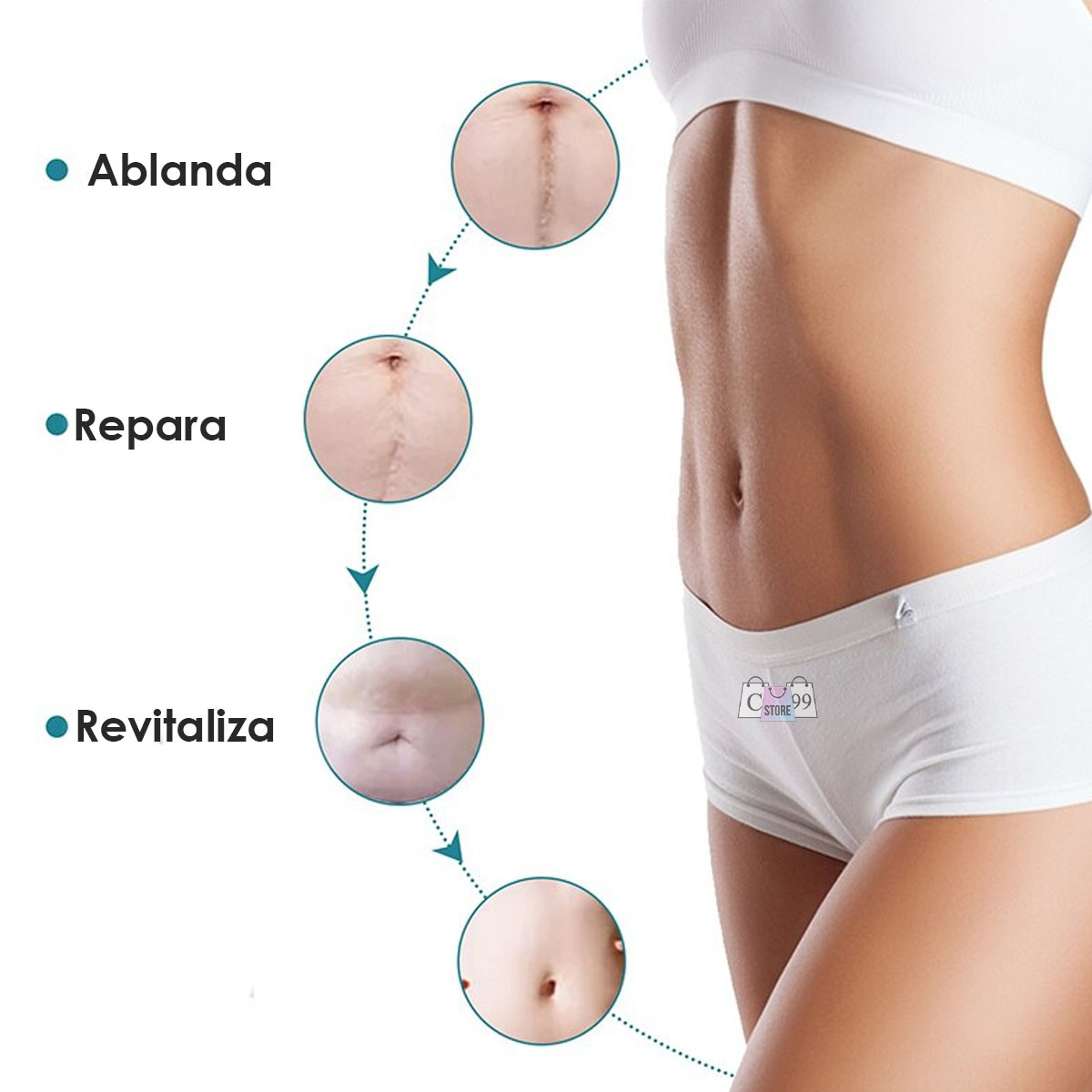 Cinta Silicona Para Eliminar Cicatrices